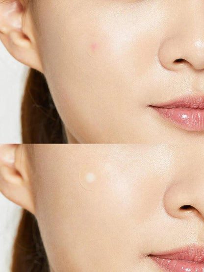 COSRX Acne Pimple Master Patch [1 sheet]